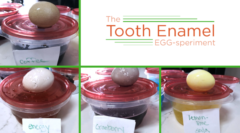 What’s Staining Your Teeth? | The Tooth Enamel Egg-speriment